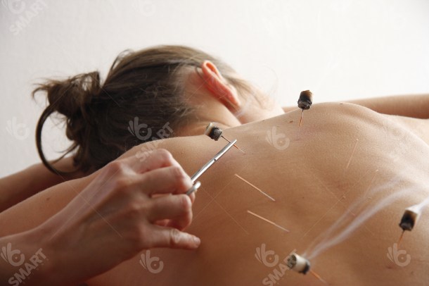4 Acupuncture Points (3300x2200)-PH 15277